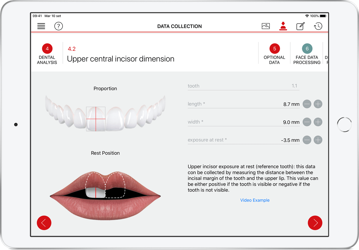 prosthetic-treatment-plan-guide-app